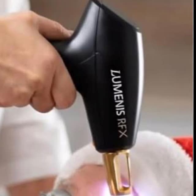 Stellar ResurFX Full Face at Skin Lux The Med Lounge in Burleson, TX